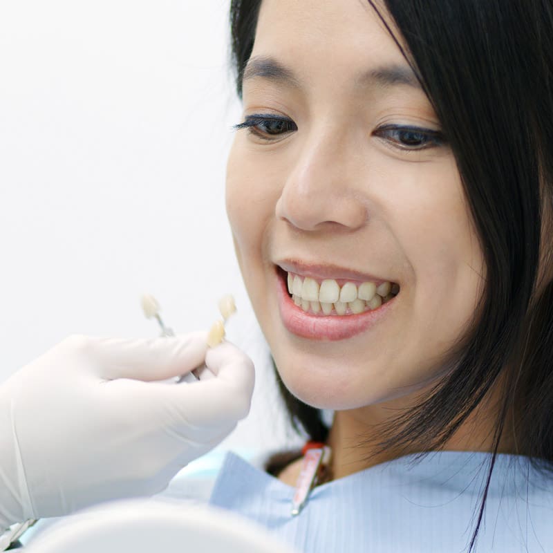 Woman compare the color of tooth sample